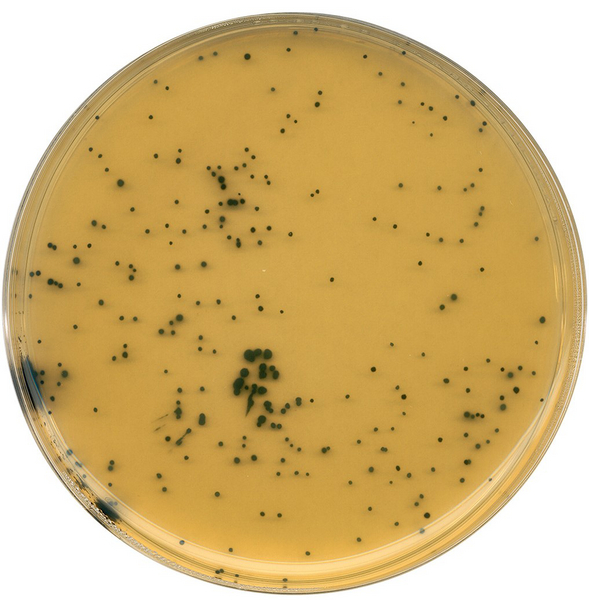 标准菌株在产气荚膜梭菌琼脂(tsc)中的生长情况