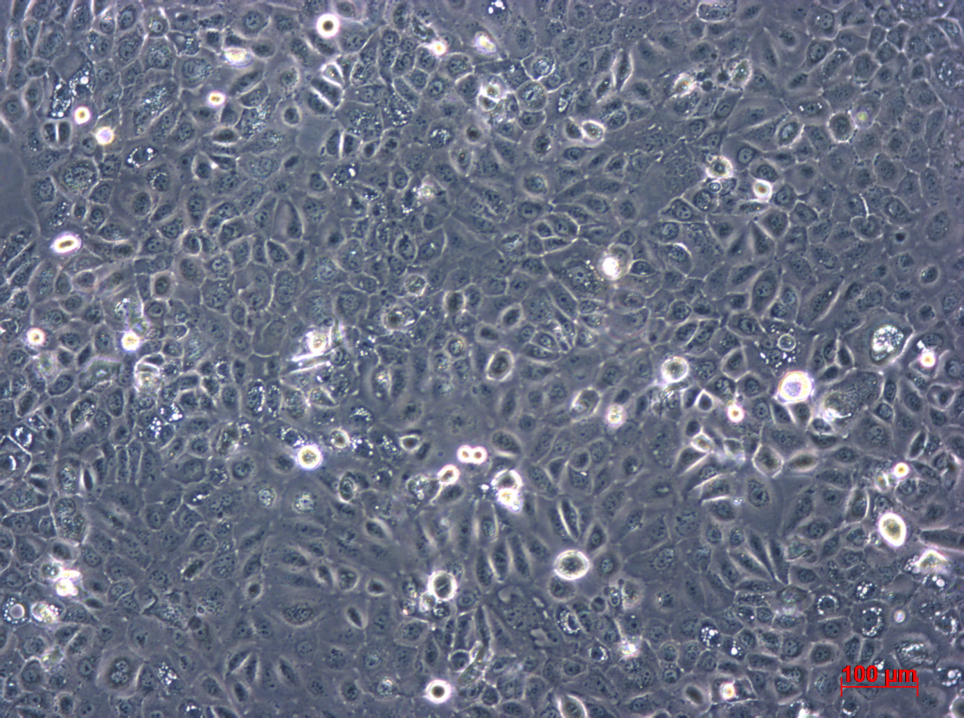 SCC-25细胞图片